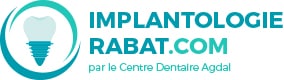 Implantologie Rabat